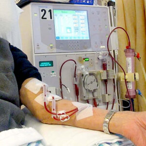 A patient receiving dialysis treatment